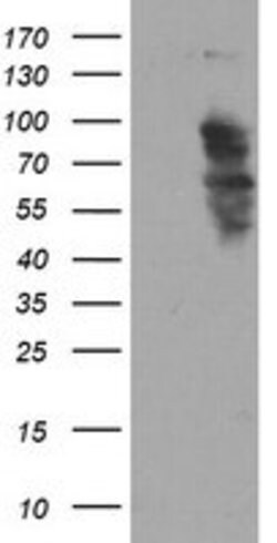 SOX5 Mouse anti-Human, Clone: OTI2A8, lyophilized, TrueMAB 100 &mu;g; Unconjugated:Antibodies,