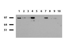 SOX5 Mouse anti-Human, Clone: UMAB53, liquid, UltraMAB 100 &mu;L; Unconjugated:Antibodies,