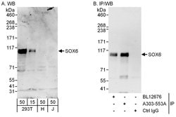 SOX6 Rabbit anti-Human, Polyclonal, Bethyl Laboratories 100 &mu;L; Unconjugated:Antibodies,