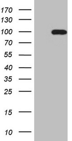 SOX6 Monoclonal Antibody (OTI1E7), TrueMAB , OriGene 100 &mu;L; Unconjugated:Antibodies,