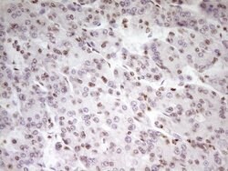 SP110 Mouse anti-Human, Clone: OTI4C1, TrueMAB , Origene 30 &mu;L; Unconjugated:Antibodies,