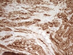 SP110 Monoclonal Antibody (OTI1C3), TrueMAB , OriGene 100 &mu;L; Unconjugated:Antibodies,