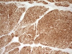 SP110 Monoclonal Antibody (OTI1C3), TrueMAB , OriGene:Antibodies:Primary