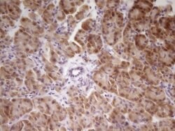 SP110 Mouse anti-Human, Clone: OTI2A1, lyophilized, TrueMAB 100 &mu;g;