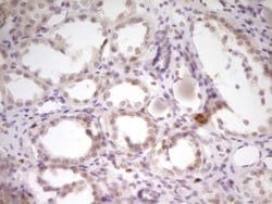SP110 Mouse anti-Human, Clone: OTI2A1, lyophilized, TrueMAB 100 &mu;g;