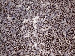 SP110 Mouse anti-Human, Clone: OTI1H5, lyophilized, TrueMAB 100 &mu;g;