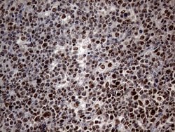 SP110 Monoclonal Antibody (OTI1H5), TrueMAB , OriGene 30 &mu;L; Unconjugated:Antibodies,