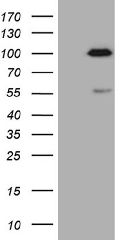 SP110 Mouse anti-Human, Clone: OTI1H5, lyophilized, TrueMAB 100 &mu;g;
