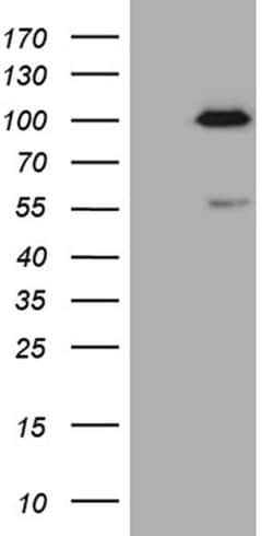 SP110 Monoclonal Antibody (OTI1H5), TrueMAB , OriGene 30 &mu;L; Unconjugated:Antibodies,