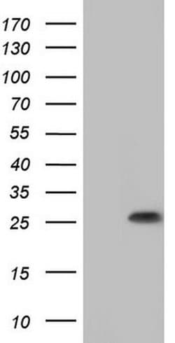 SPA17 Monoclonal Antibody (OTI1G1), TrueMAB , OriGene 100 &mu;L; Unconjugated:Antibodies,
