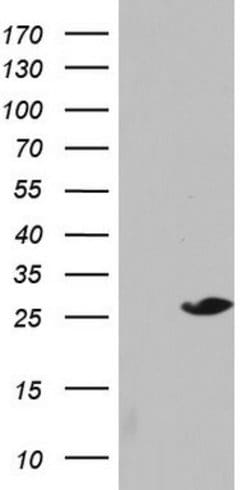 SPA17 Mouse anti-Human, Clone: OTI6F10, lyophilized, TrueMAB 100 &mu;g | Buy Online | Origene Technologies | Fisher Scientific