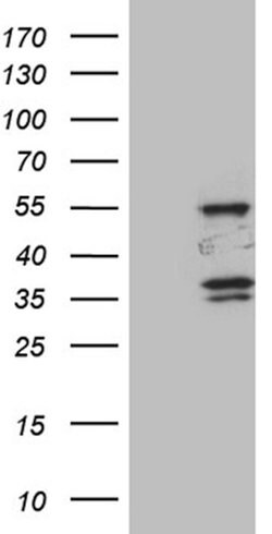 SPAG4 Mouse anti-Human, Clone: OTI3E9, lyophilized, TrueMAB 100 &mu;g;
