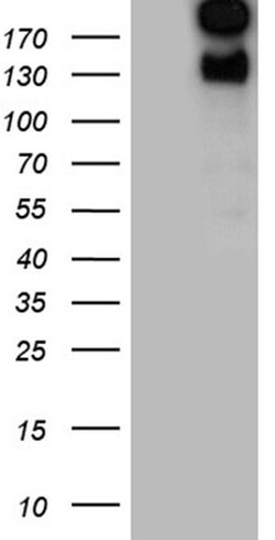 SPAG5 Monoclonal Antibody (OTI2F2), TrueMAB , OriGene 30 &mu;L; Unconjugated:Antibodies,