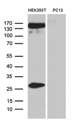 SPAG5 Mouse anti-Human, Clone: OTI3F10, lyophilized, TrueMAB 100 &mu;g;