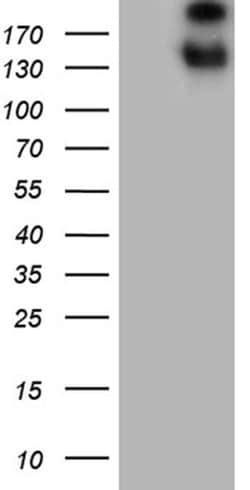 SPAG5 Monoclonal Antibody (OTI5B2), TrueMAB , OriGene:Antibodies:Primary