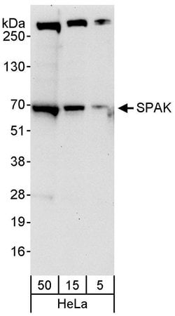 SPAK Rabbit anti-Human, Polyclonal, Bethyl Laboratories 100 &mu;L; Unconjugated:Antibodies,