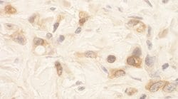SPAK Polyclonal Antibody, Bethyl Laboratories 100 &mu;L | Buy Online | Bethyl Laboratories, Inc | Fisher Scientific