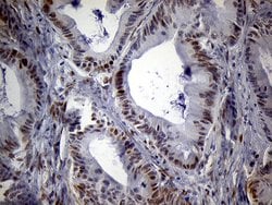 SPANXB1 Mouse anti-Human, Clone: OTI1E11, liquid, TrueMAB 100 &mu;L; Unconjugated:Antibodies,