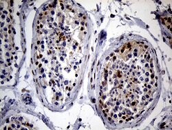 SPANXB1 Mouse anti-Human, Clone: OTI1E11, liquid, TrueMAB 100 &mu;L; Unconjugated:Antibodies,