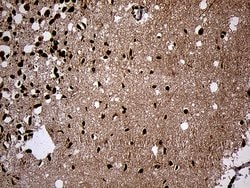 SPANXB1 Mouse anti-Human, Clone: OTI6G2, liquid, TrueMAB 100 &mu;L; Unconjugated:Antibodies,