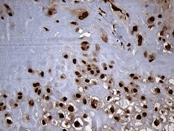 SPANXB1 Mouse anti-Human, Clone: OTI6G2, liquid, TrueMAB 100 &mu;L; Unconjugated:Antibodies,