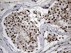 SPANXB1 Mouse anti-Human, Clone: OTI6G2, liquid, TrueMAB 100 &mu;L; Unconjugated:Antibodies,