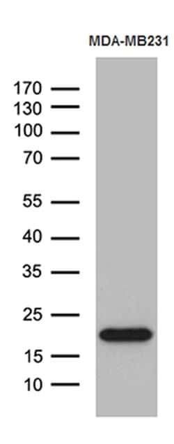 SPANXB1 Mouse anti-Human, Clone: OTI1E11, lyophilized, TrueMAB 100 &mu;g;