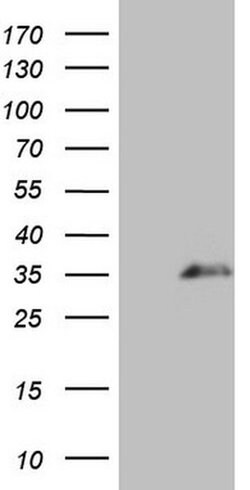 SPANXN3 Monoclonal Antibody (OTI4B1), TrueMAB , OriGene 100 &mu;L; Unconjugated:Antibodies,