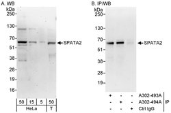 SPATA2 Rabbit anti-Human, Polyclonal, Bethyl Laboratories 100 &mu;L; Unconjugated:Antibodies,