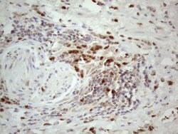 SPATA22 Monoclonal Antibody (OTI6H9), TrueMAB , OriGene 100 &mu;L; Unconjugated:Antibodies,