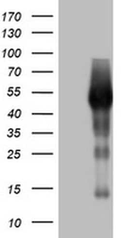 SPATA2L Monoclonal Antibody (OTI2B4), TrueMAB , OriGene:Antibodies:Primary