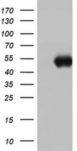 SPATA2L Monoclonal Antibody (OTI2E2), TrueMAB , OriGene:Antibodies:Primary