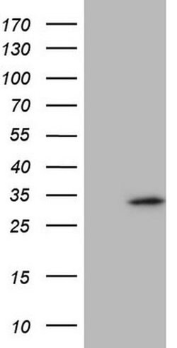 SPC25 Monoclonal Antibody (OTI3D11), TrueMAB , OriGene:Antibodies:Primary