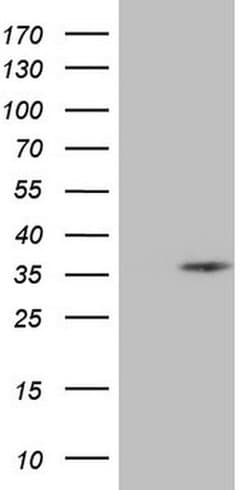 SPC25 Monoclonal Antibody (OTI1F8), TrueMAB , OriGene:Antibodies:Primary