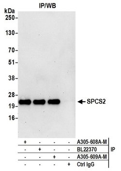 SPCS2 Polyclonal Antibody, Bethyl Laboratories 20 &mu;L; Unconjugated:Antibodies,