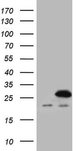 SPCS2 Monoclonal Antibody (OTI1E4), TrueMAB , OriGene 30 &mu;L | Buy Online | Origene Technologies | Fisher Scientific