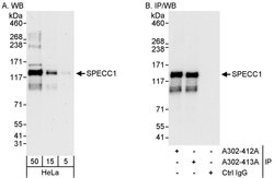 SPECC1 Rabbit anti-Human, Polyclonal, Bethyl Laboratories 100 &mu;L; Unconjugated:Antibodies,