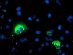 SPG7 Monoclonal Antibody (OTI1E5), TrueMAB , OriGene 30 &mu;L; Unconjugated:Antibodies,