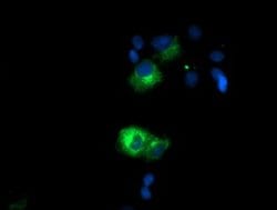 SPG7 Monoclonal Antibody (OTI1D10), TrueMAB , OriGene 100 &mu;L; Unconjugated:Antibodies,
