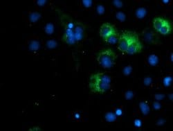 SPG7 Monoclonal Antibody (OTI5H7), TrueMAB , OriGene 100 &mu;L; Unconjugated:Antibodies,