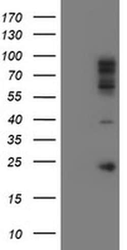 SPG7 Monoclonal Antibody (OTI2B9), TrueMAB , OriGene:Antibodies:Primary