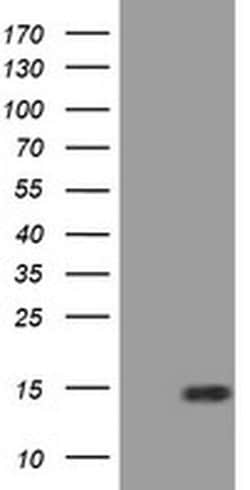 SPG7 Monoclonal Antibody (OTI5H7), TrueMAB , OriGene 100 &mu;L; Unconjugated:Antibodies,