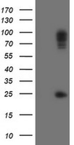 SPG7 Monoclonal Antibody (OTI7D10), TrueMAB , OriGene 100 &mu;L; Unconjugated:Antibodies,