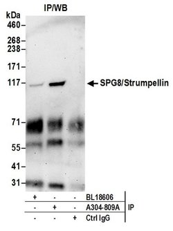 SPG8/Strumpellin Rabbit anti-Human, Mouse, Polyclonal, Bethyl Laboratories 100 &mu;L | Buy Online | Bethyl Laboratories, Inc | Fisher Scientific