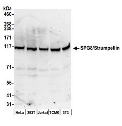 SPG8/Strumpellin Polyclonal Antibody, Bethyl Laboratories 20 &mu;L | Buy Online | Bethyl Laboratories, Inc | Fisher Scientific