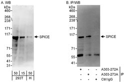 SPICE Rabbit anti-Human, Polyclonal, Bethyl Laboratories 100 &mu;L; Unconjugated:Antibodies,