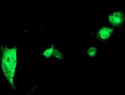 SPINT1 Mouse anti-Canine, Human, Mouse, Rat, Clone: OTI4H2, lyophilized,