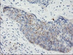 SPINT1 Monoclonal Antibody (OTI1E2), TrueMAB , OriGene 100 &mu;L; Unconjugated:Antibodies,