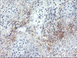 SPINT1 Mouse anti-Human, Clone: OTI1E2, lyophilized, TrueMAB 100 &mu;g;