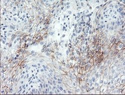 SPINT1 Monoclonal Antibody (OTI1E2), TrueMAB , OriGene 100 &mu;L; Unconjugated:Antibodies,